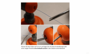 Kupferkette GyneFIX®: Faden wird mit einer Pinzette als Schlaufe in den Gebärmutterhalskanal zurückgelegt