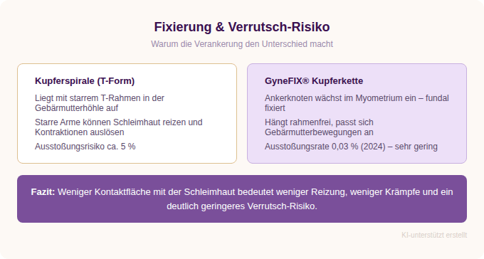 Infografik: Kupferspirale vs. GyneFIX Kupferkette – Fixierung und Ausstoßungsrisiko im Vergleich