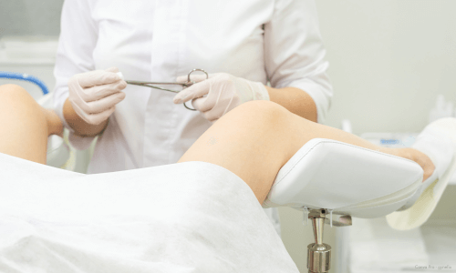 gynaekologische untersuchung zum wechxsel der kupferkette gynefix