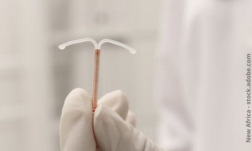 Hormonfreie Verh tungsmethoden Verhueten gynefix de Hormonfreie Verh tungsmethoden Verhueten gynefix de