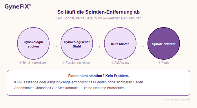 Infografik: Spirale entfernen Ablauf in 4 Schritten – kein Schnitt, keine Narkose
