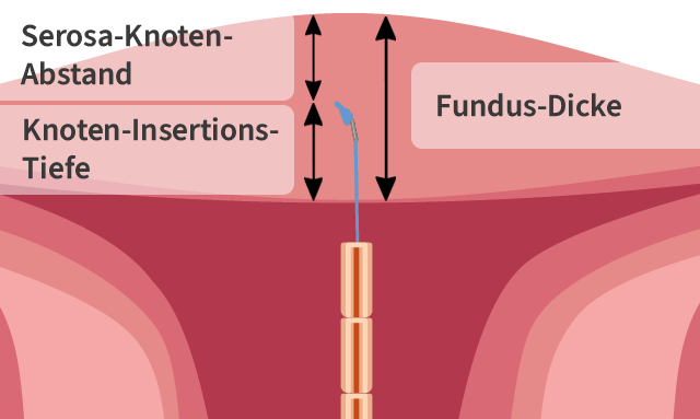 gynefix_fundus_deutsch