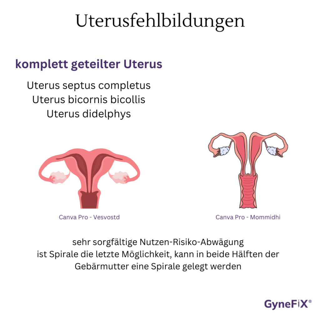 verhuetung bei uterusfehlbildungen