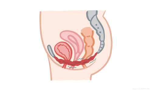 grafik beckenmodenmuskulatur uterus blase und enddarm